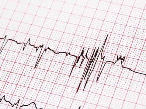 heart monitor graph