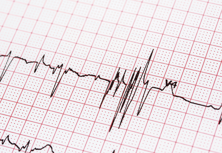 heart monitor graph